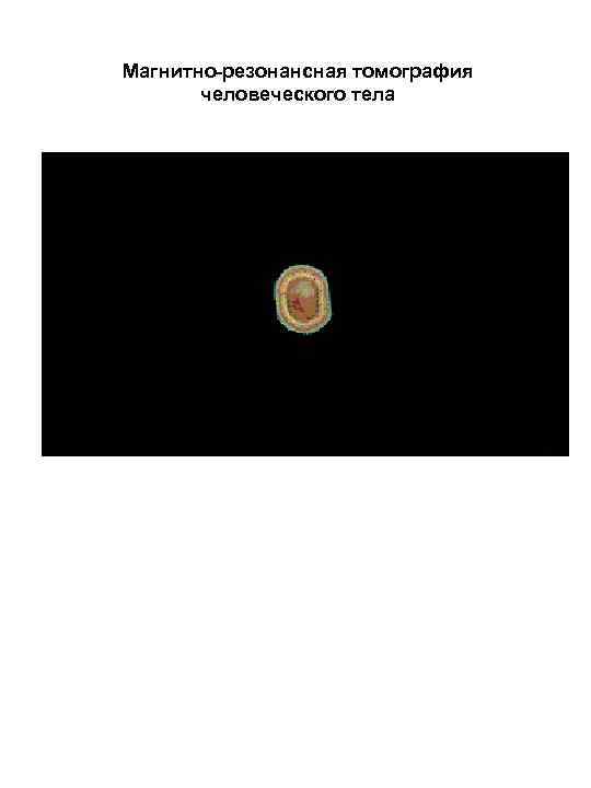 Магнитно-резонансная томография  человеческого тела 