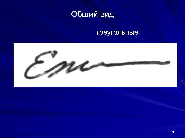 Общий вид треугольные 33 Общий вид треугольные 33