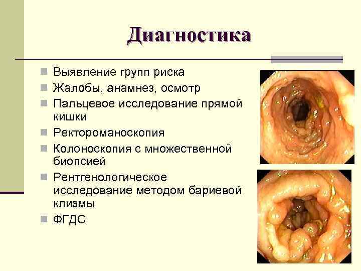 Диагностика n Выявление групп риска n Жалобы, анамнез, осмотр n Диагностика n Выявление групп риска n Жалобы, анамнез, осмотр n