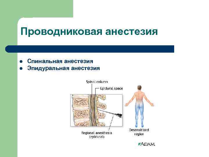 Проводниковая анестезия l  Спинальная анестезия l  Эпидуральная анестезия    
