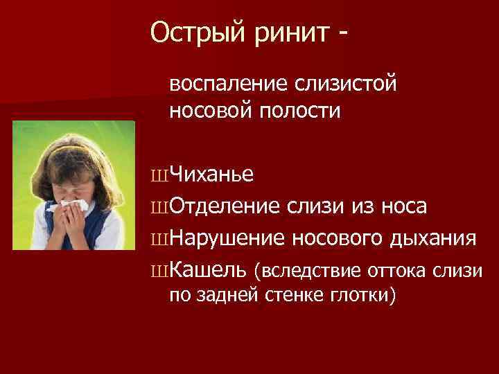 Острый ринит -  воспаление слизистой  носовой полости ШЧиханье ШОтделение слизи из носа