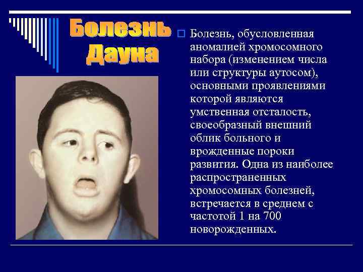 o Болезнь, обусловленная  аномалией хромосомного  набора (изменением числа  или структуры аутосом),