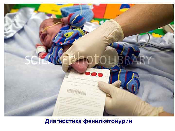 Диагностика фенилкетонурии 