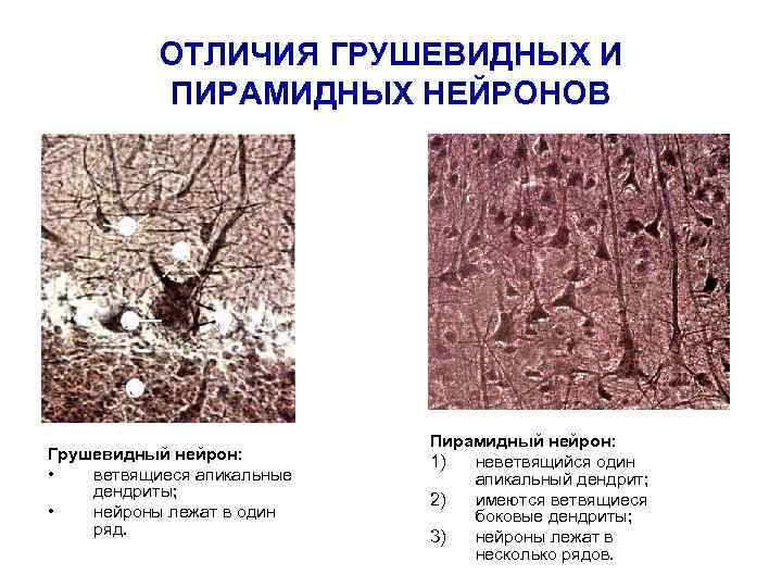   ОТЛИЧИЯ ГРУШЕВИДНЫХ И  ПИРАМИДНЫХ НЕЙРОНОВ      
