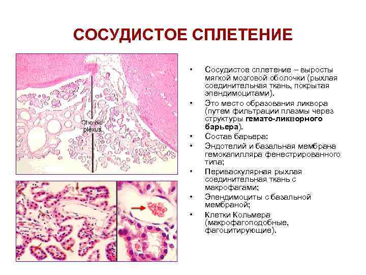 СОСУДИСТОЕ СПЛЕТЕНИЕ  •  Сосудистое сплетение – выросты    мягкой мозговой