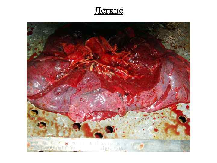 Легкие 
