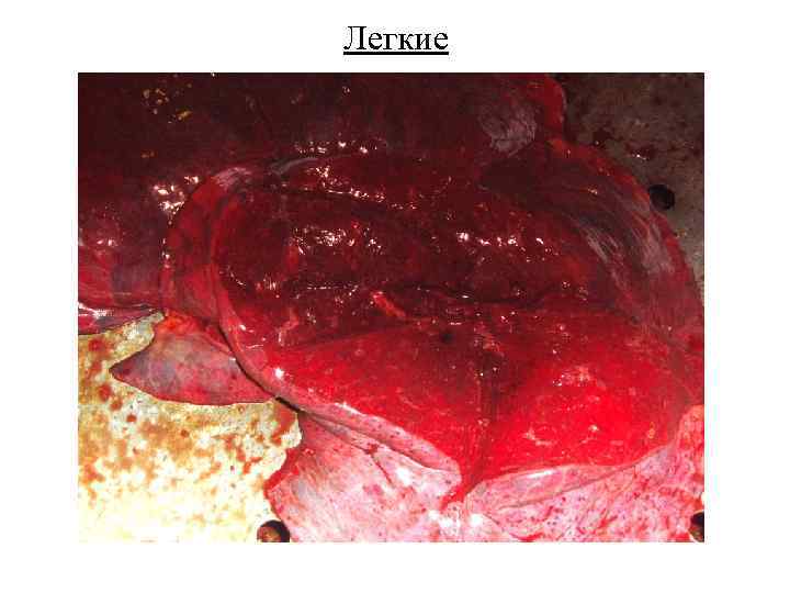 Легкие 