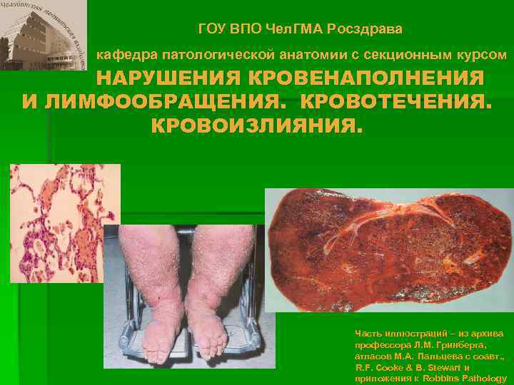     ГОУ ВПО Чел. ГМА Росздрава кафедра патологической анатомии с секционным