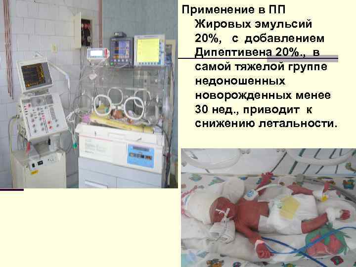 Применение в ПП  Жировых эмульсий  20%, с добавлением  Дипептивена 20%. ,