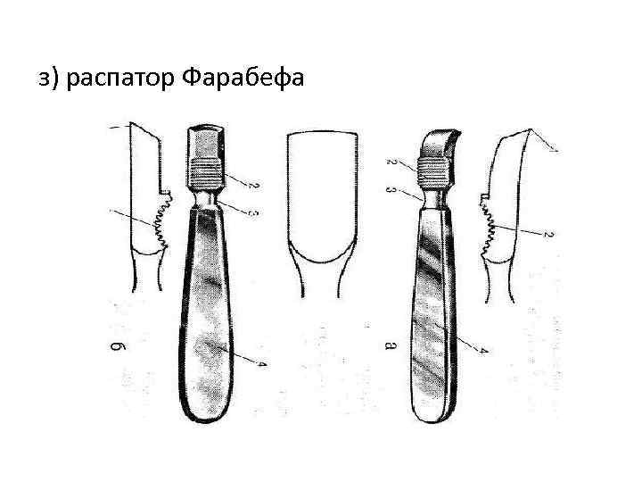 з) распатор Фарабефа 