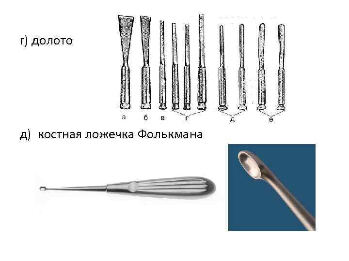 г) долото д) костная ложечка Фолькмана 