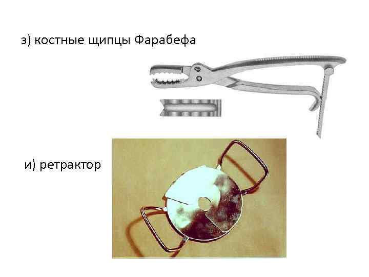 Фарабефа инструмент хирургия фото