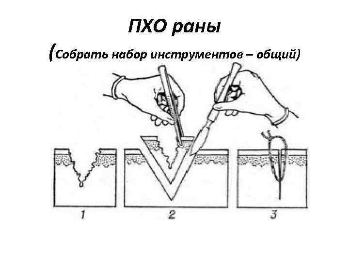  ПХО раны (Собрать набор инструментов – общий) 