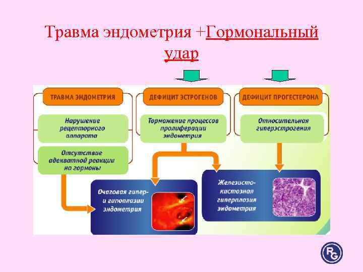 Травма эндометрия +Гормональный удар Травма эндометрия +Гормональный удар