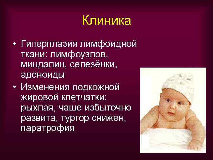    Клиника • Гиперплазия лимфоидной  ткани: лимфоузлов,  миндалин, селезёнки, 