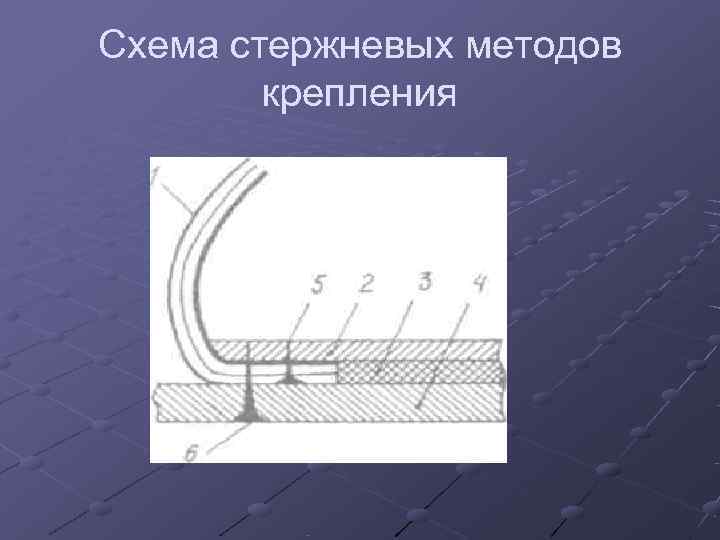 Схема стержневых методов   крепления 