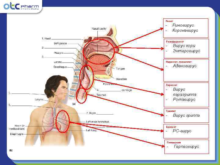 Ринит -  Риновирус -  Коронавирус Ринофарингит -  Вирус кори - 