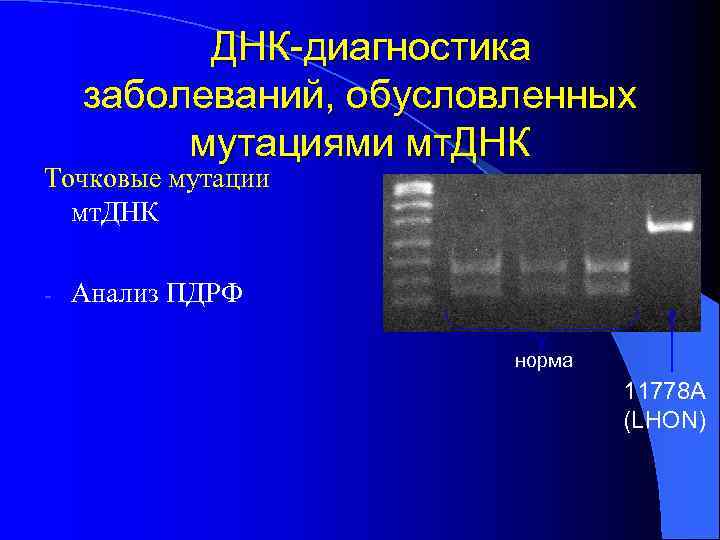 Ядерная днк. Мутация фрагмента ДНК на электрофорезе. Патологии ядерной ДНК.