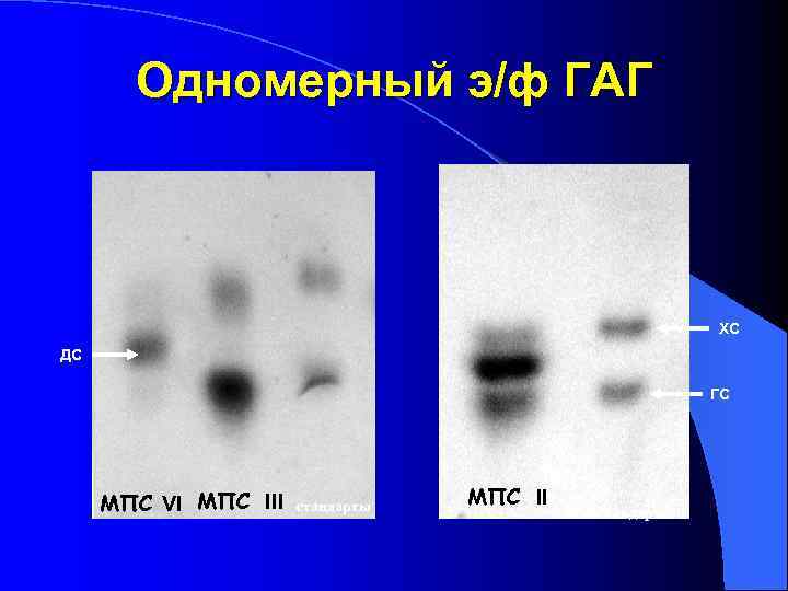  Одномерный э/ф ГАГ     ХС ДС   