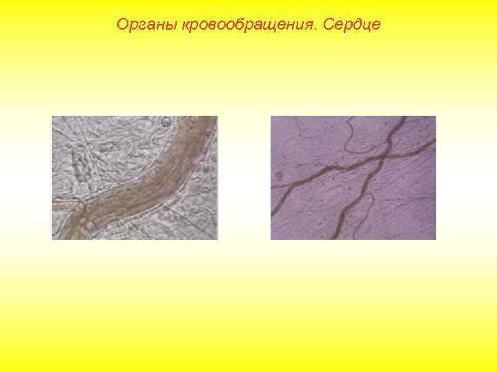 Органы кровообращения. Сердце 