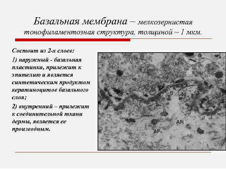  Базальная мембрана – мелкозернистая  тонофиламентозная структура, толщиной ~ 1 мкм.  Состоит
