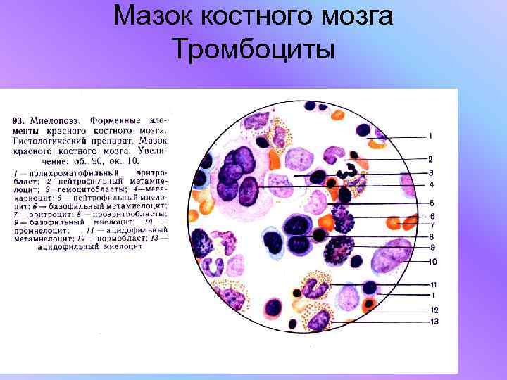 Мазок костного мозга  Тромбоциты 