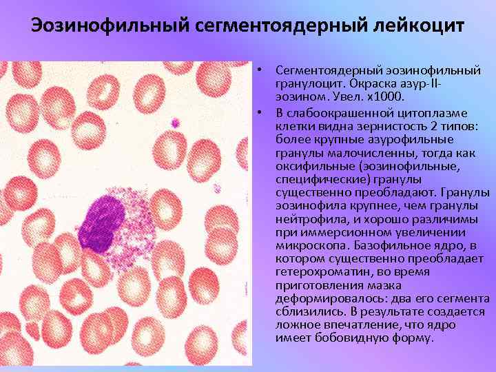 Сегментоядерные нейтрофилы фото под микроскопом