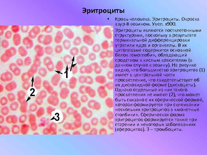 Эритроциты  •  Кровь человека. Эритроциты. Окраска   азур-II-эозином. Увел. х900. 