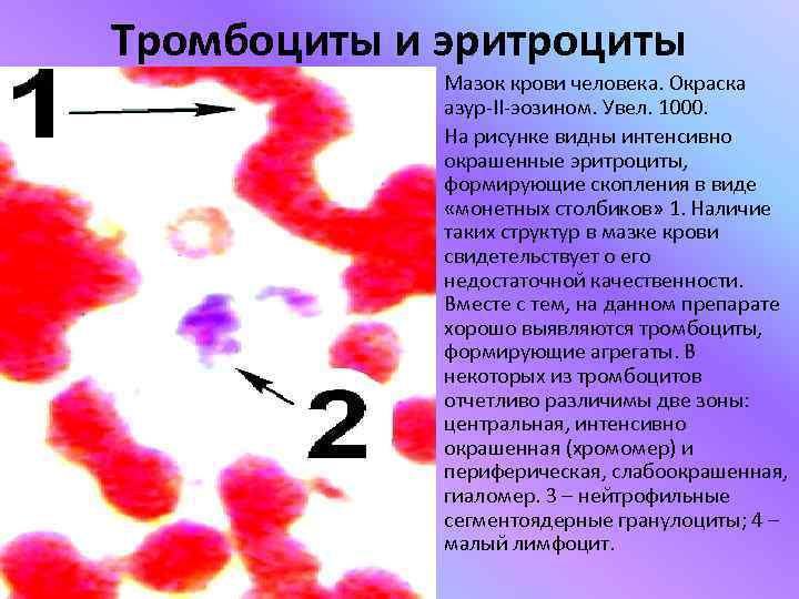 Эритроциты в мазке. Мазок крови человека окраска Азур 2 эозином. Агрегаты тромбоцитов в мазке крови. Эритроциты окрашены. Тромбоциты мазок крови.