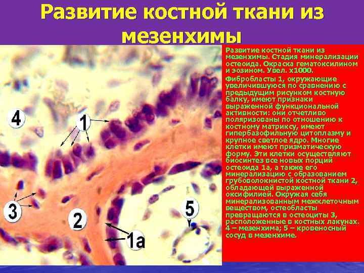 Развитие костной ткани из  мезенхимы. Развитие костной ткани из   мезенхимы. Стадия