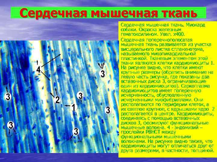 Сердечная мышечная ткань   Сердечная мышечная ткань. Миокард   собаки. Окраска железным