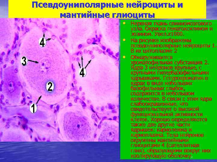 Псевдоуниполярные нейроциты и мантийные глиоциты    • Нервная ткань спинномозгового  