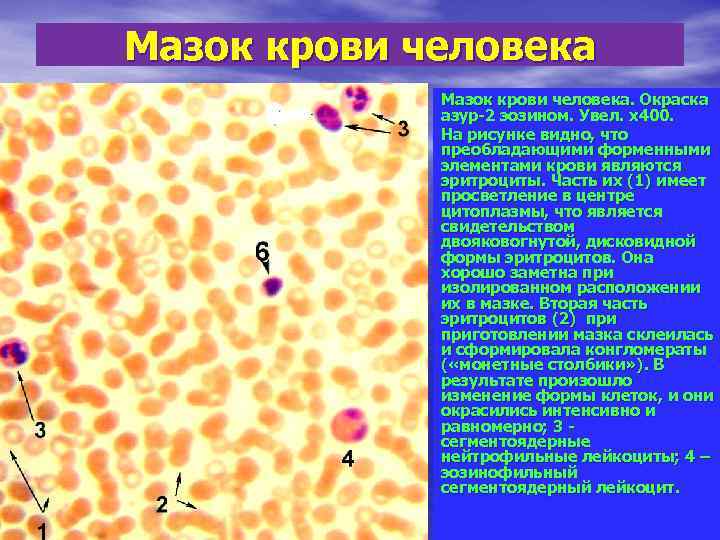 Многочисленные мелкие тельца. Мазок крови лягушки гематоксилин-эозин. Мазок крови лягушки гистология. Окраска Азур 2 эозином. Кровь лягушки окраска эозин Азур 2.