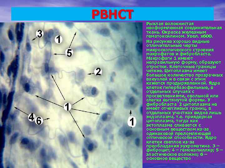 РВНСТ  •  Рыхлая волокнистая  неоформленная соединительная  ткань. Окраска железным 