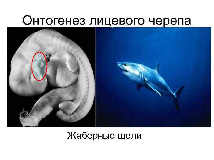 Онтогенез лицевого черепа  Жаберные щели 