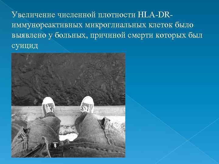 Увеличение численной плотности HLA-DR- иммунореактивных микроглиальных клеток было выявлено у больных, причиной смерти которых