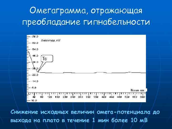   Омегаграмма, отражающая  преобладание гипнабельности Снижение исходных величин омега-потенциала до выхода на