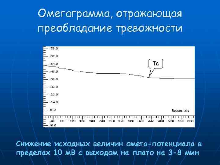  Омегаграмма, отражающая преобладание тревожности     Амплитуда, m. V Снижение исходных