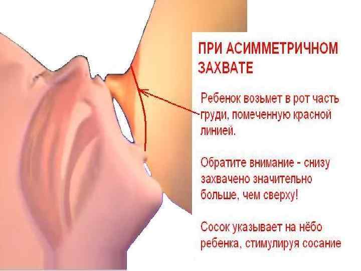 Основные принципы прикладывания 