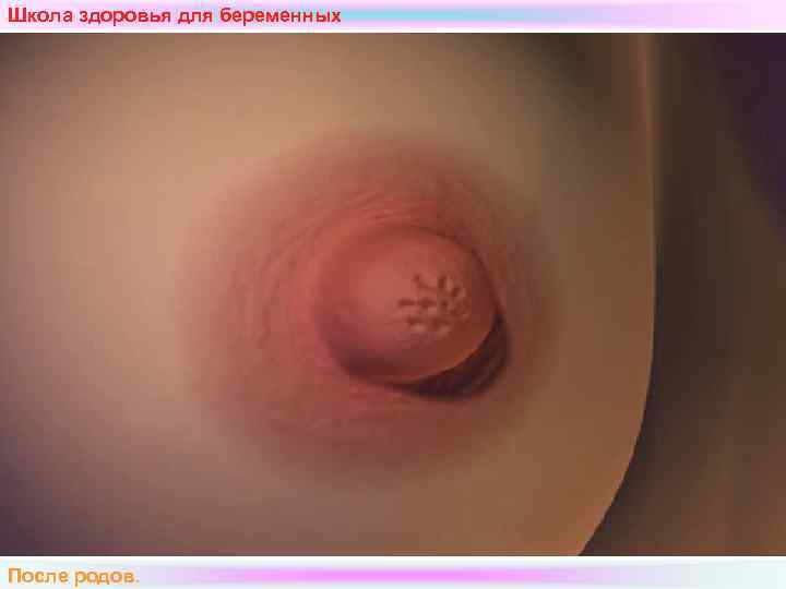 Школа здоровья для беременных После родов.  