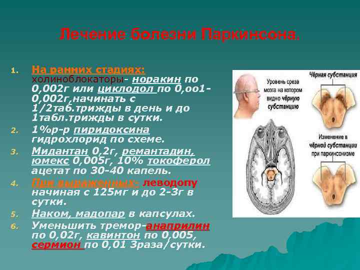    Лечение болезни Паркинсона.  1.  На ранних стадиях:  холиноблокаторы-