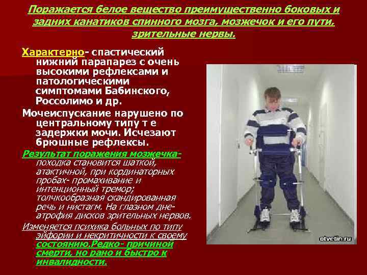  Поражается белое вещество преимущественно боковых и  задних канатиков спинного мозга, мозжечок и