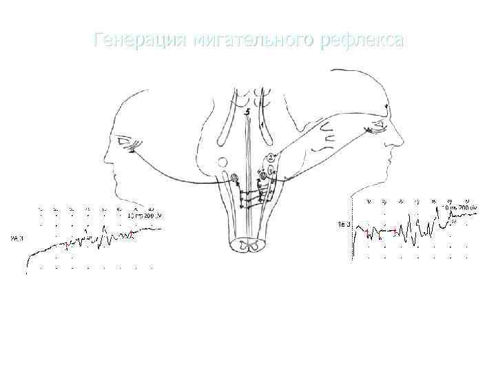   Генерация мигательного рефлекса 1 –n. tractus mesencephalicus N. Trigemini, 2 – n.