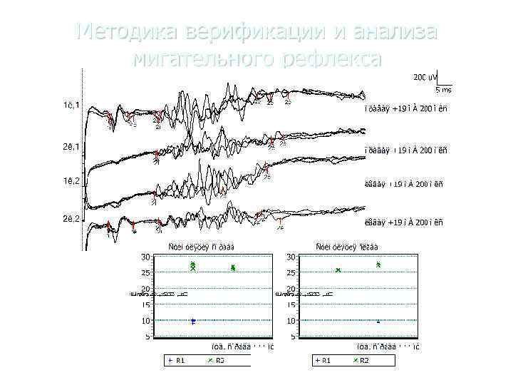 Методика верификации и анализа мигательного рефлекса 