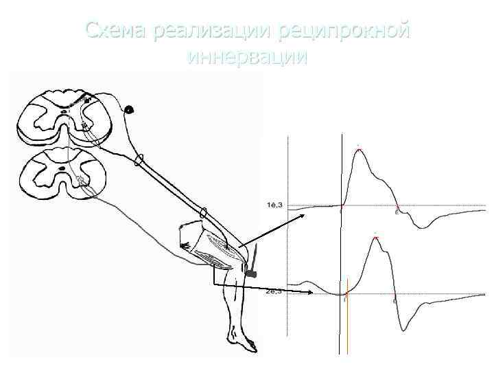 Схема реализации реципрокной  иннервации 