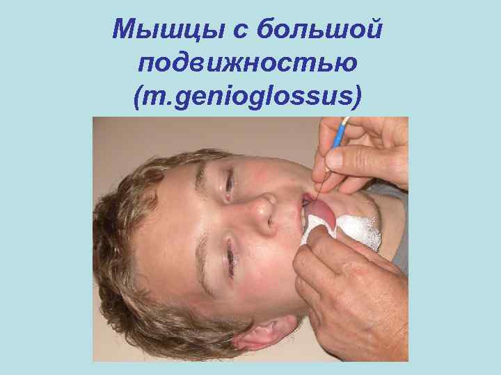 Мышцы с большой подвижностью (m. genioglossus) Мышцы с большой подвижностью (m. genioglossus)