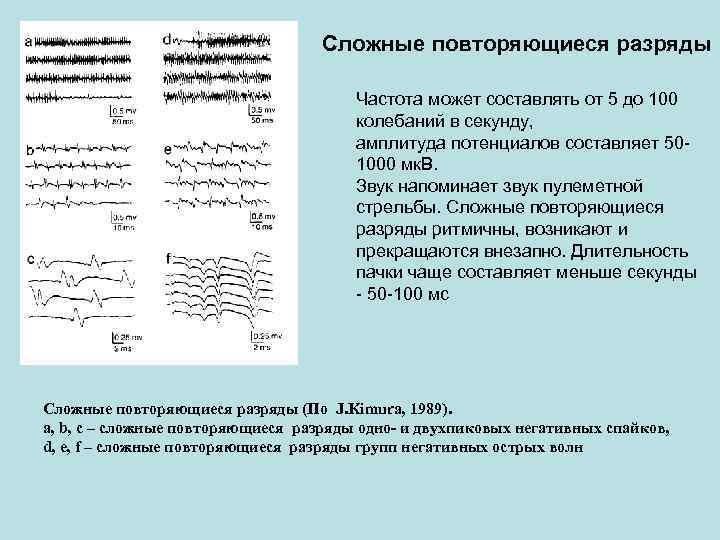 Сложные повторяющиеся разряды Сложные повторяющиеся разряды