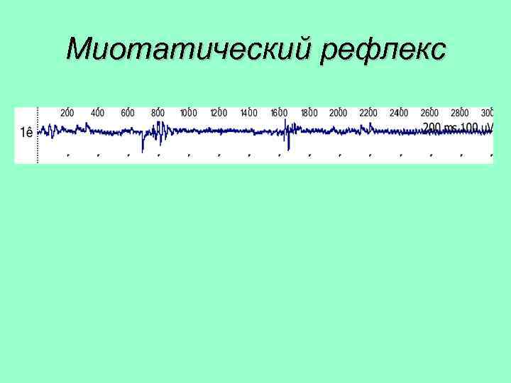 Миотатический рефлекс 