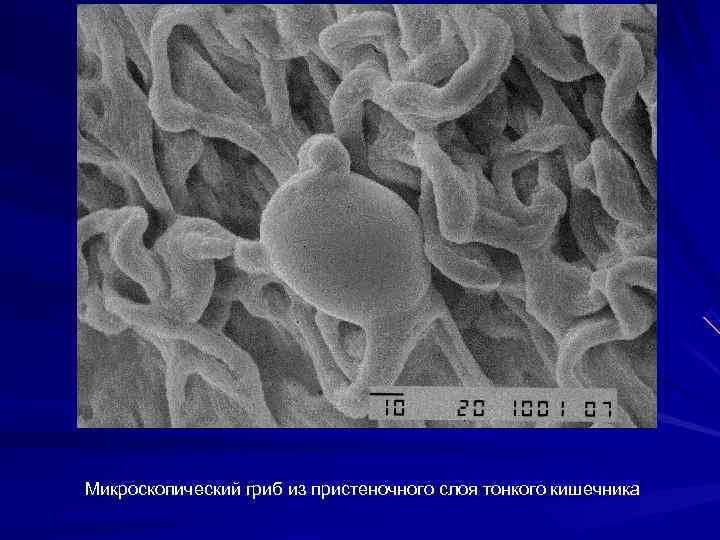  Микроскопический гриб из пристеночного слоя тонкого кишечника 