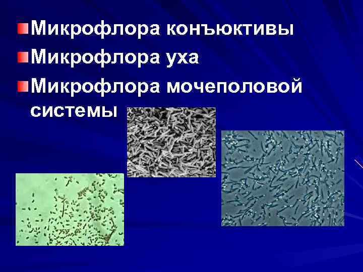 Микрофлора конъюктивы Микрофлора уха Микрофлора мочеполовой системы 